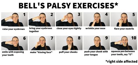 bell's palsy physical therapy pdf